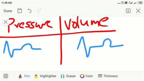 lv pressure overload|life expectancy with lvh.